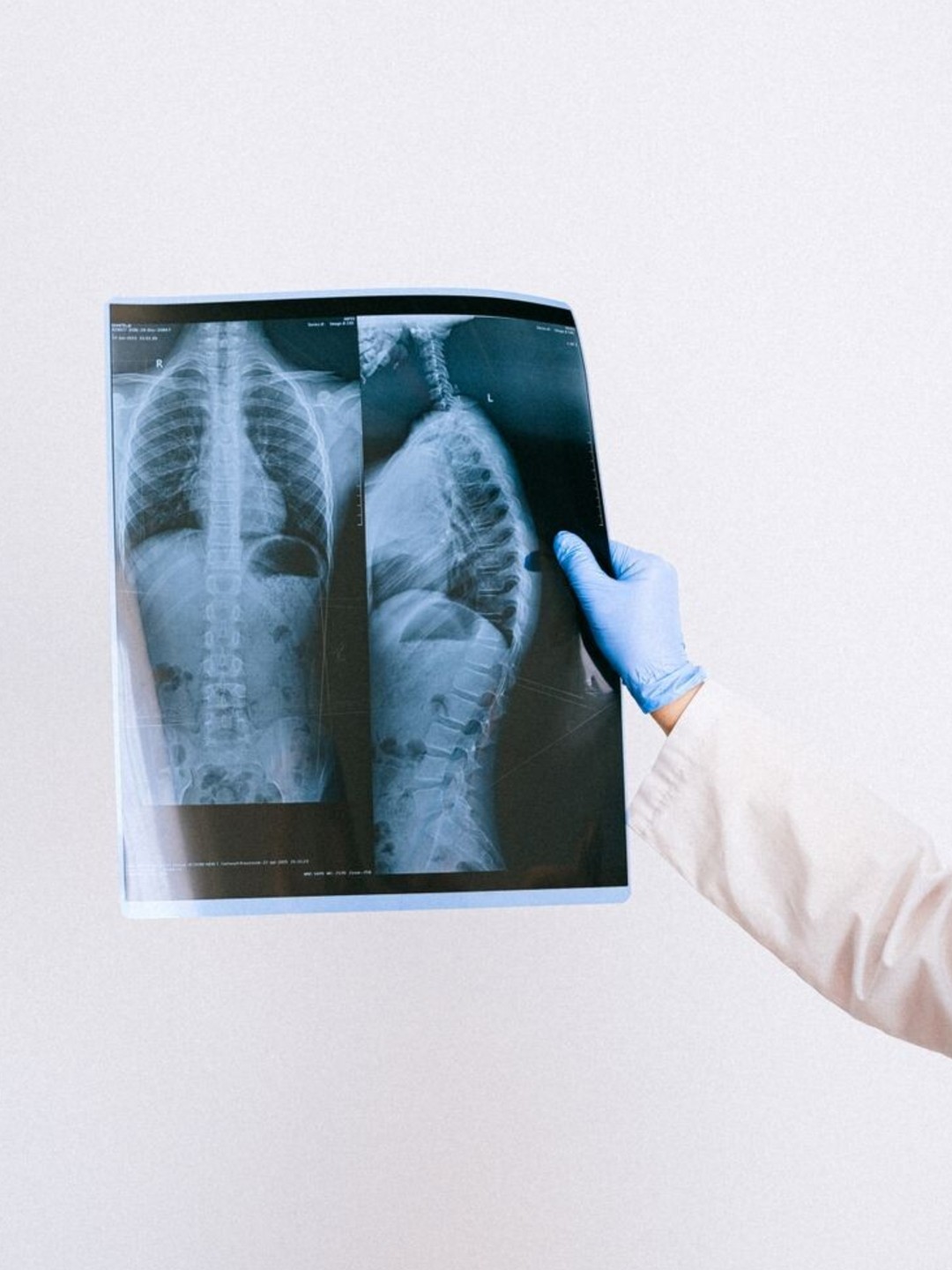 Medizinische Technologin Radiologie / MTR / MTRA (w/m/d)